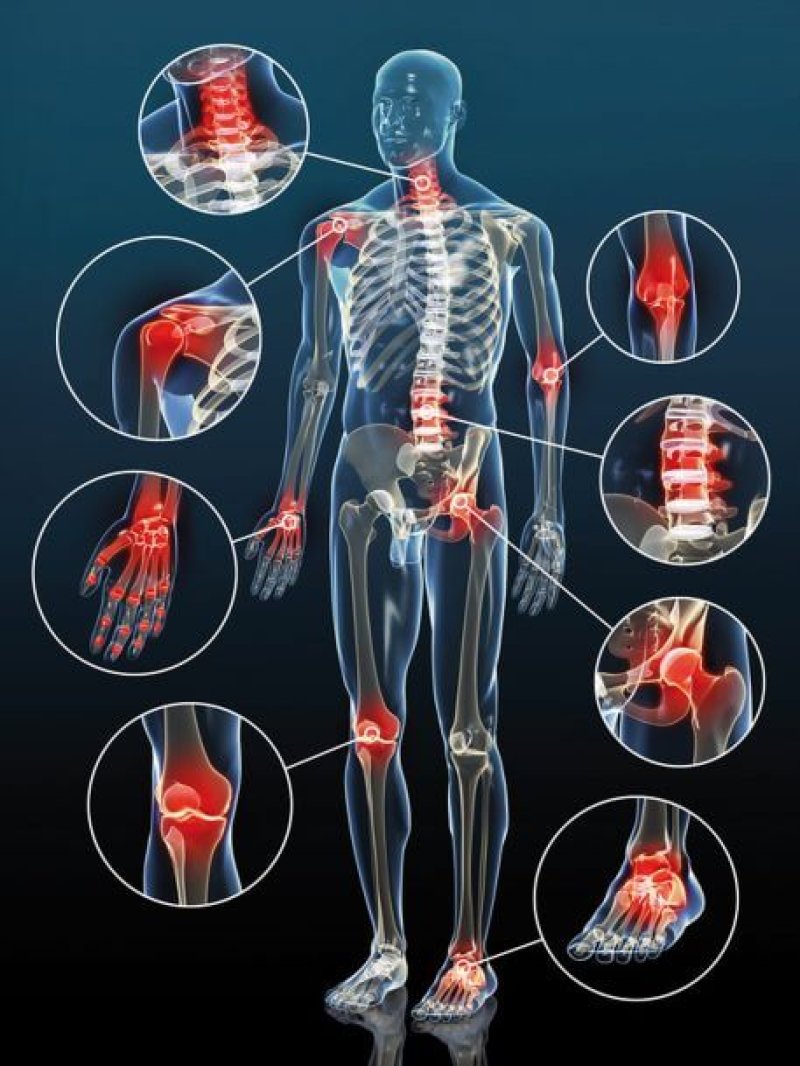 PROBLÈMES D'ARTICULATIONS